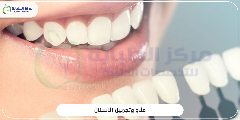 علاج وتجميل الأسنان علاج الاسنان تجميل الاسنان