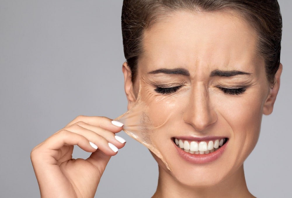 التقشير البارد للوجه