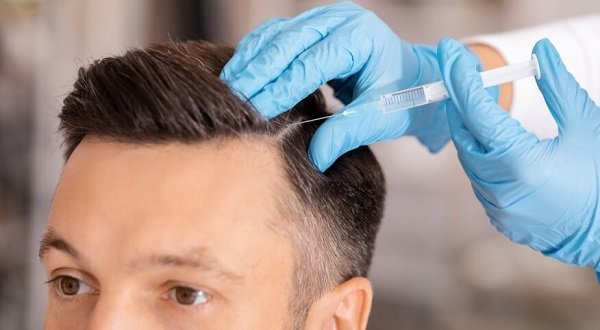 تقنية حقن الميزوثيرابي للشعر666