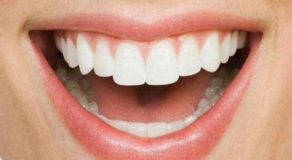 حشوات الاسنان السيراميك